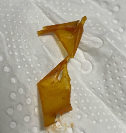 토마토 껍질 예시사진 2