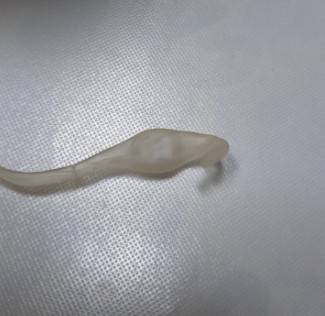 망울 이미지 예시 2