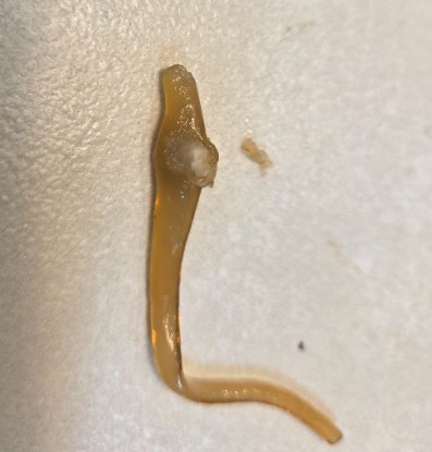 망울 이미지 예시 1